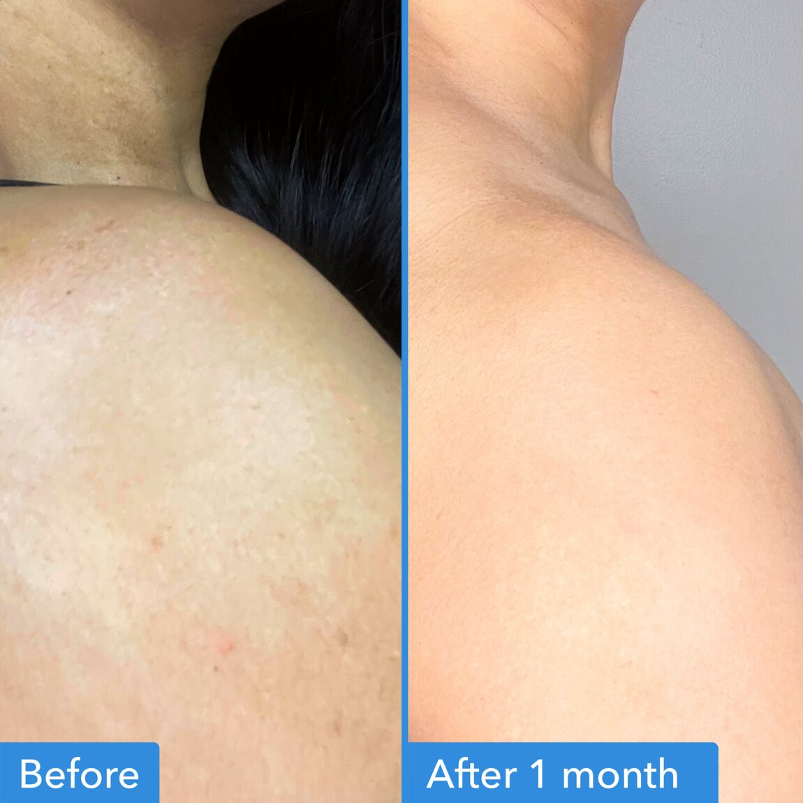 discoloration-correcting-body-treatment-a1 zb_p.jpg