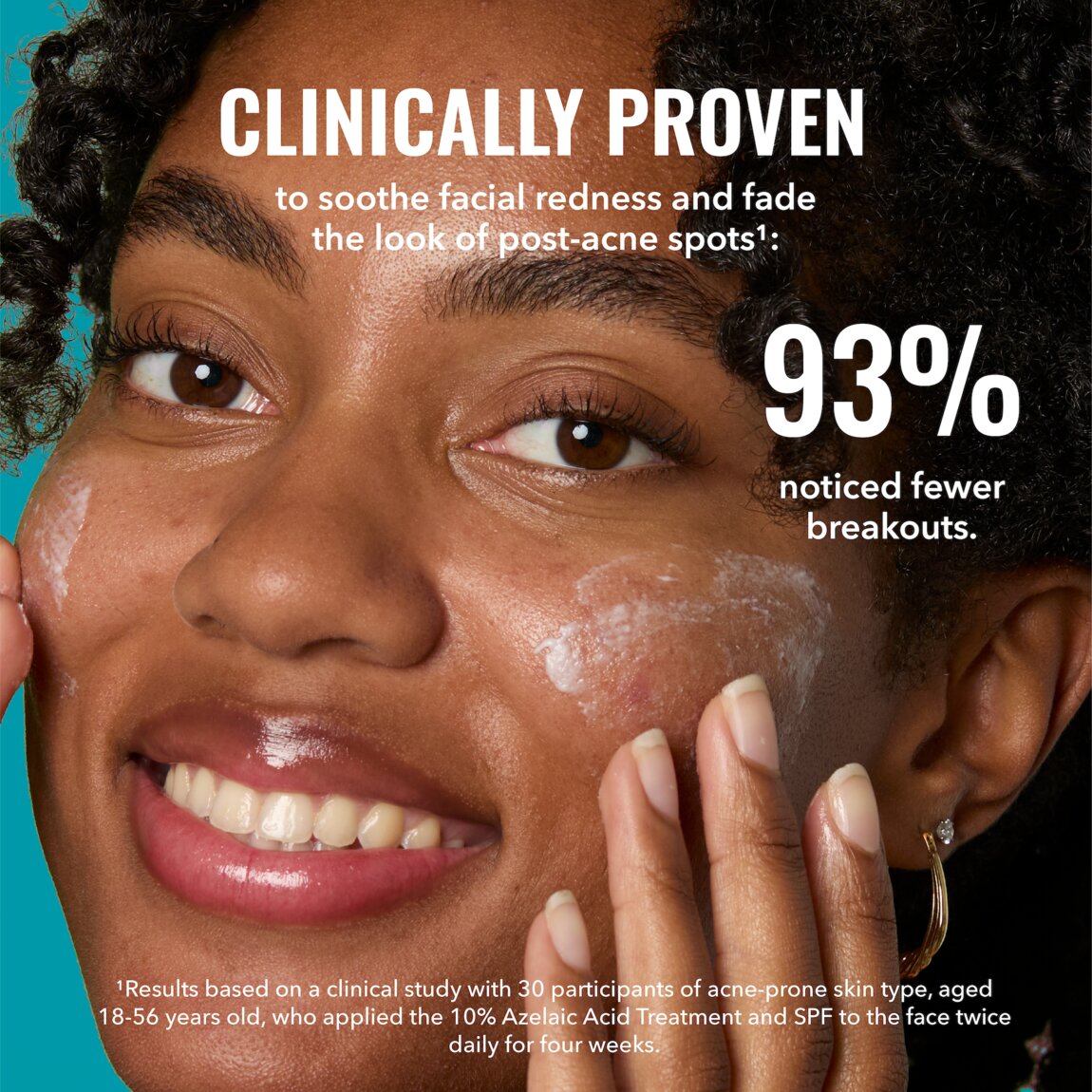 10-azelaic-acid-treatment-f7 zb_p.jpg