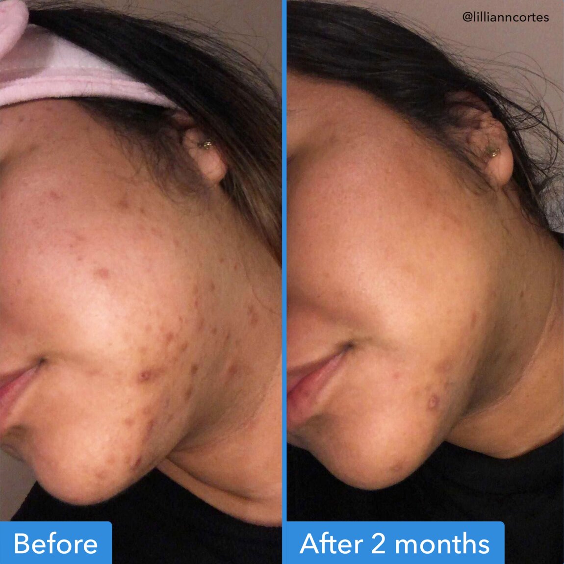 discoloration-correcting-serum-x9 zb_p.jpg